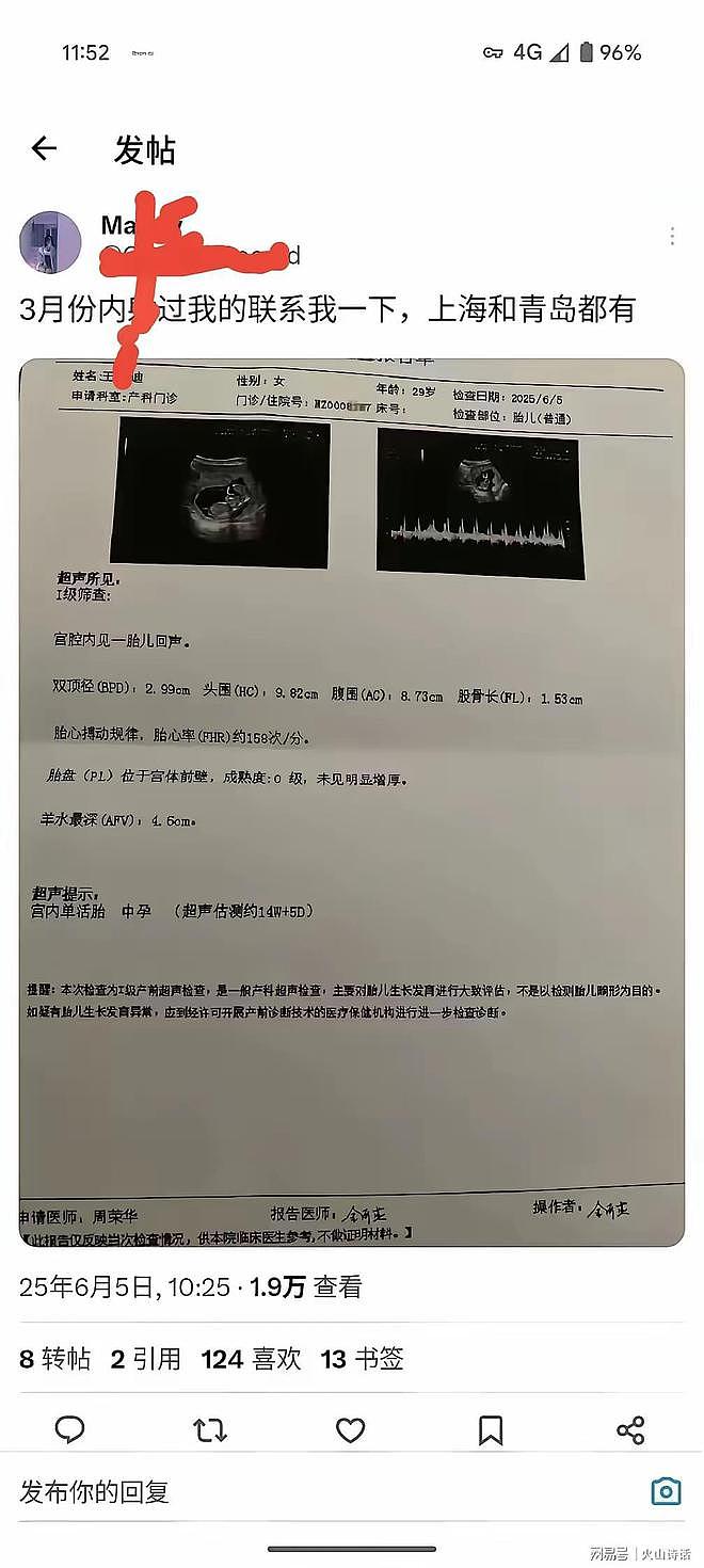“3月份睡过我的联系一下”一女子发帖给3个月胎儿找亲爹,称上海和青岛的都有可能(组图) - 2