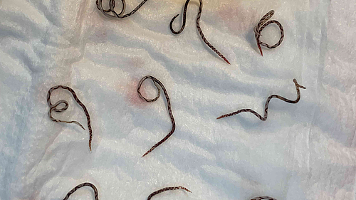 华人注意!脑部寄生虫蔓延澳东,感染途径你想不到,人类防范(组图) - 4