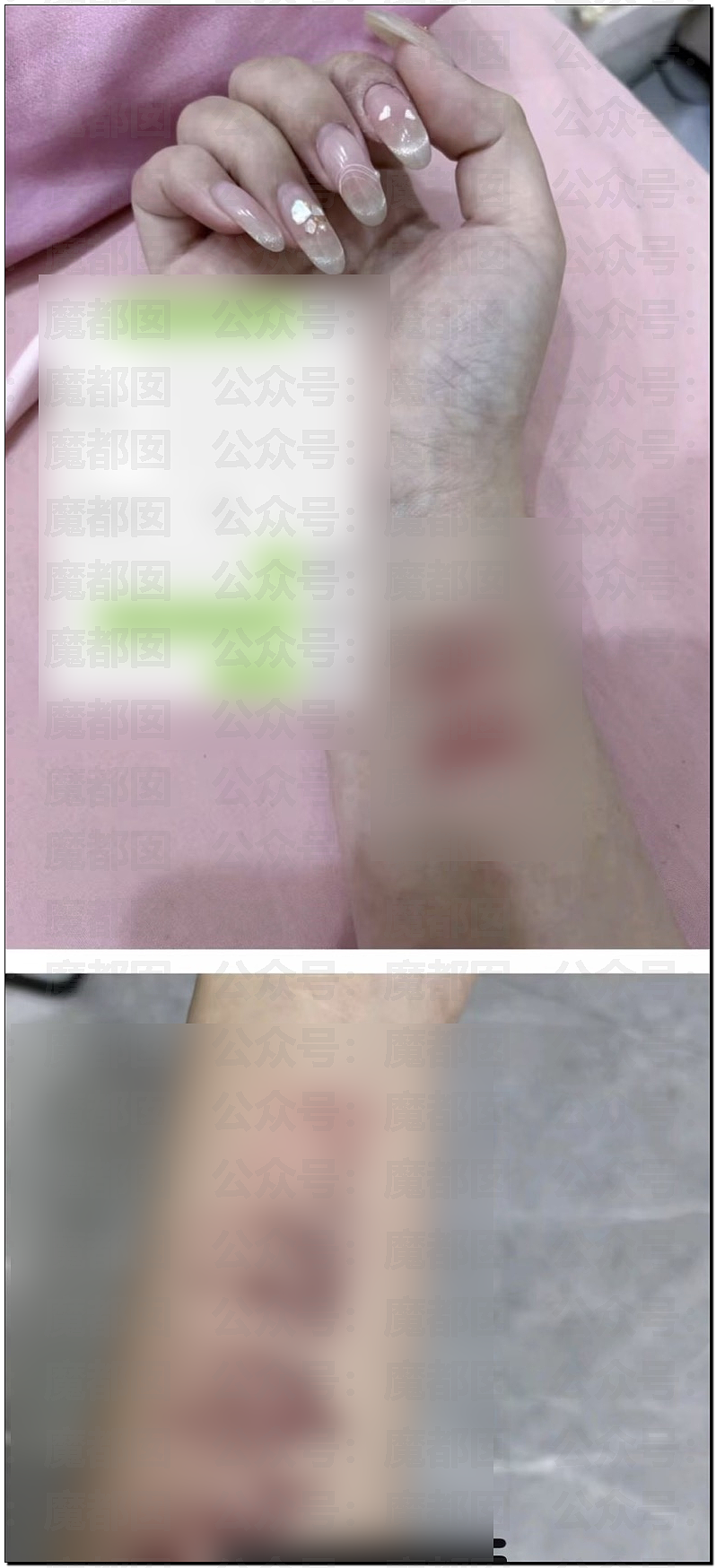警惕！女生和男网友奔现，睡10天分手，女方承受不住割腕！（组图） - 18
