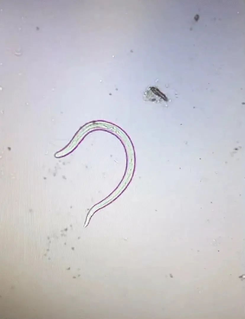华人注意!脑部寄生虫蔓延澳东,感染途径你想不到,人类防范(组图) - 3