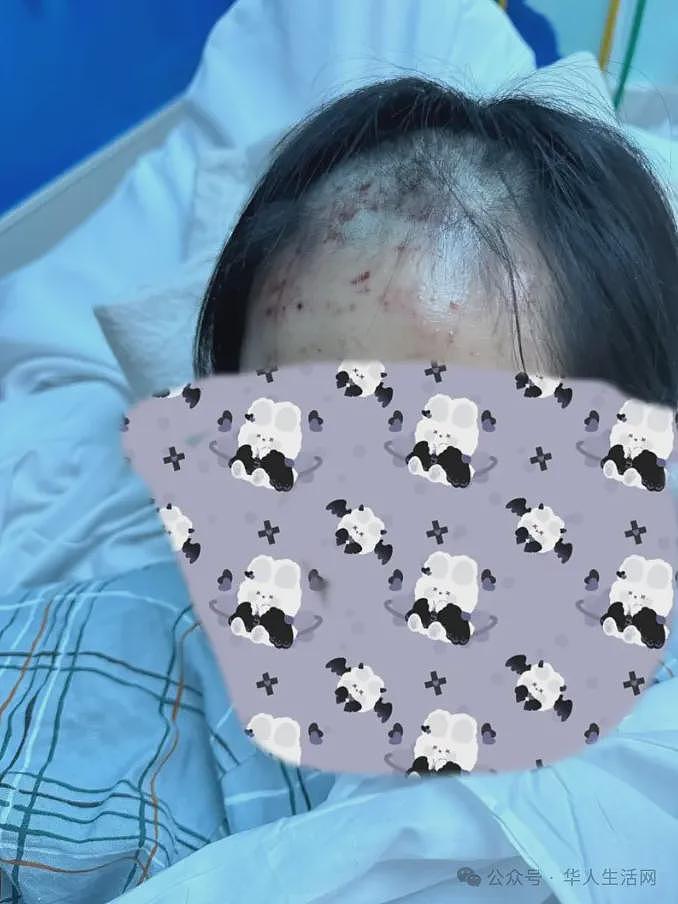 2华裔少女遭群殴，7青少年被控谋杀未遂等重罪（组图） - 3