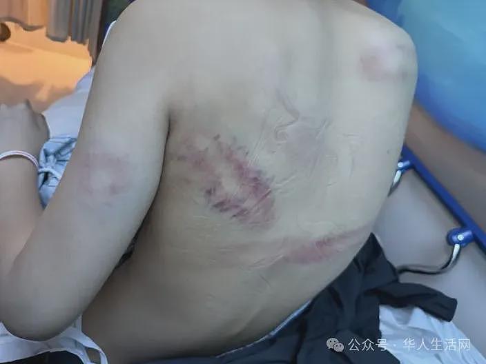 2华裔少女遭群殴，7青少年被控谋杀未遂等重罪（组图） - 2