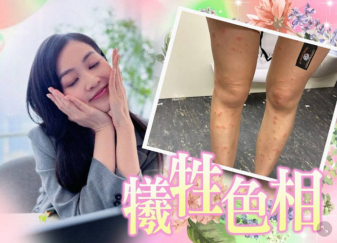 TVB女星突然毁容!半夜突然窒息,紧急送医打针保命!突然翻红被力捧(组图) - 6
