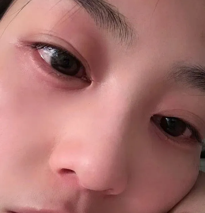 TVB女星突然毁容!半夜突然窒息,紧急送医打针保命!突然翻红被力捧(组图) - 16
