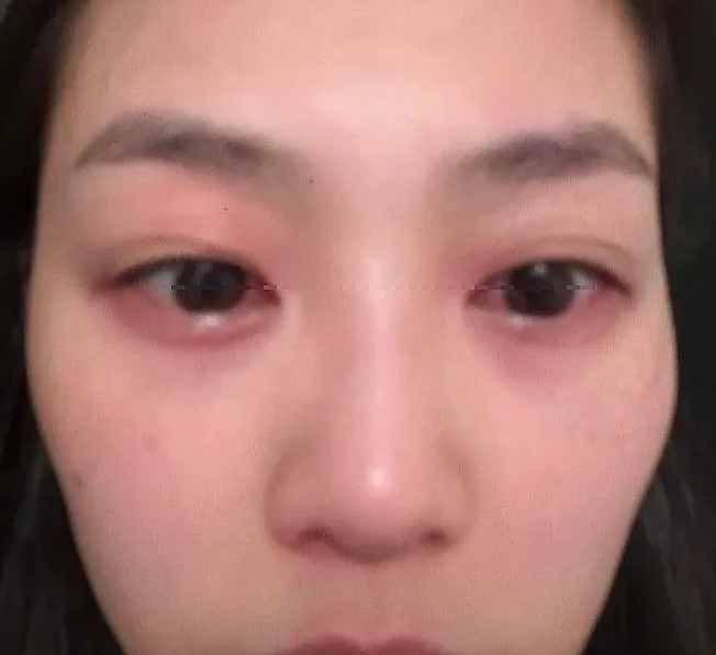 TVB女星突然毁容!半夜突然窒息,紧急送医打针保命!突然翻红被力捧(组图) - 2