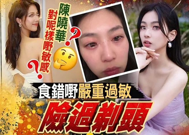TVB女星突然毁容!半夜突然窒息,紧急送医打针保命!突然翻红被力捧(组图) - 1