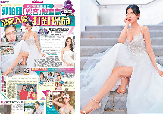 TVB女星突然毁容!半夜突然窒息,紧急送医打针保命!突然翻红被力捧(组图) - 18
