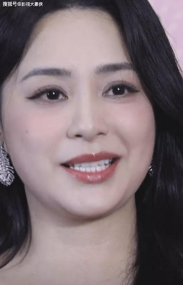 阿娇出席活动，脸大脖子粗，身材发福挡不住（组图） - 5