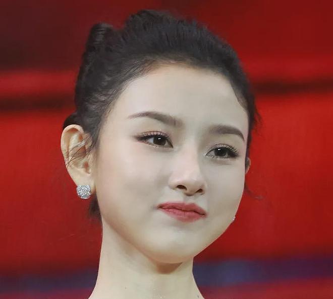 27岁宋祖儿脸部浮肿四肢瘦，疑似进食障碍长期催吐，状态惹人担忧（组图） - 5