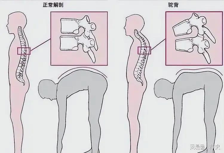 不死癌症击倒周杰伦,音乐天才被疾病困扰,简单动作都成挑战(组图) - 6