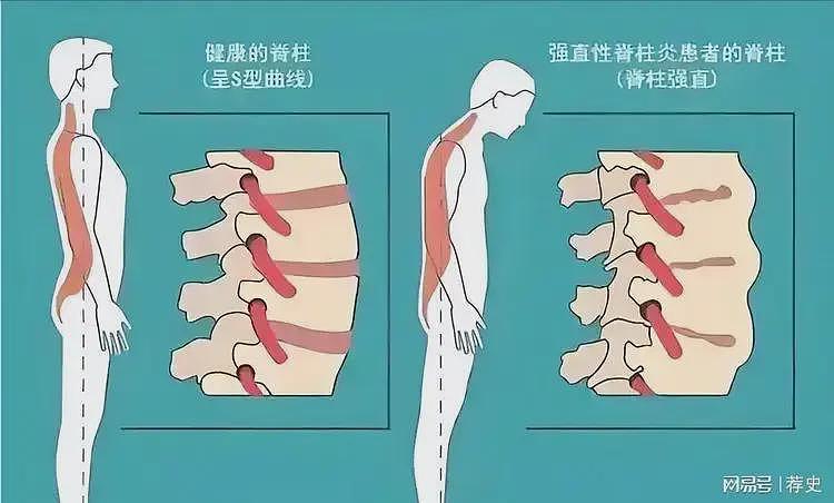 不死癌症击倒周杰伦,音乐天才被疾病困扰,简单动作都成挑战(组图) - 5