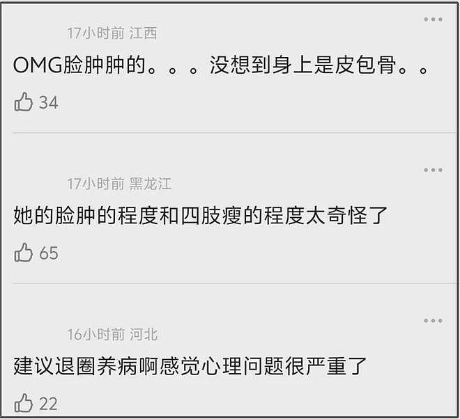 27岁宋祖儿脸部浮肿四肢瘦，疑似进食障碍长期催吐，状态惹人担忧（组图） - 22