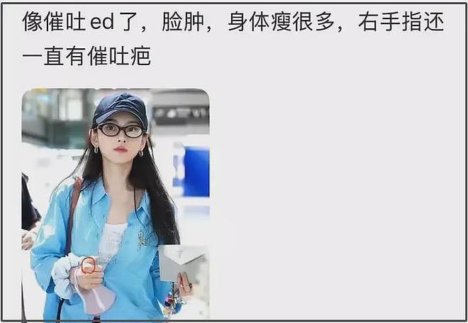 27岁宋祖儿脸部浮肿四肢瘦，疑似进食障碍长期催吐，状态惹人担忧（组图） - 21