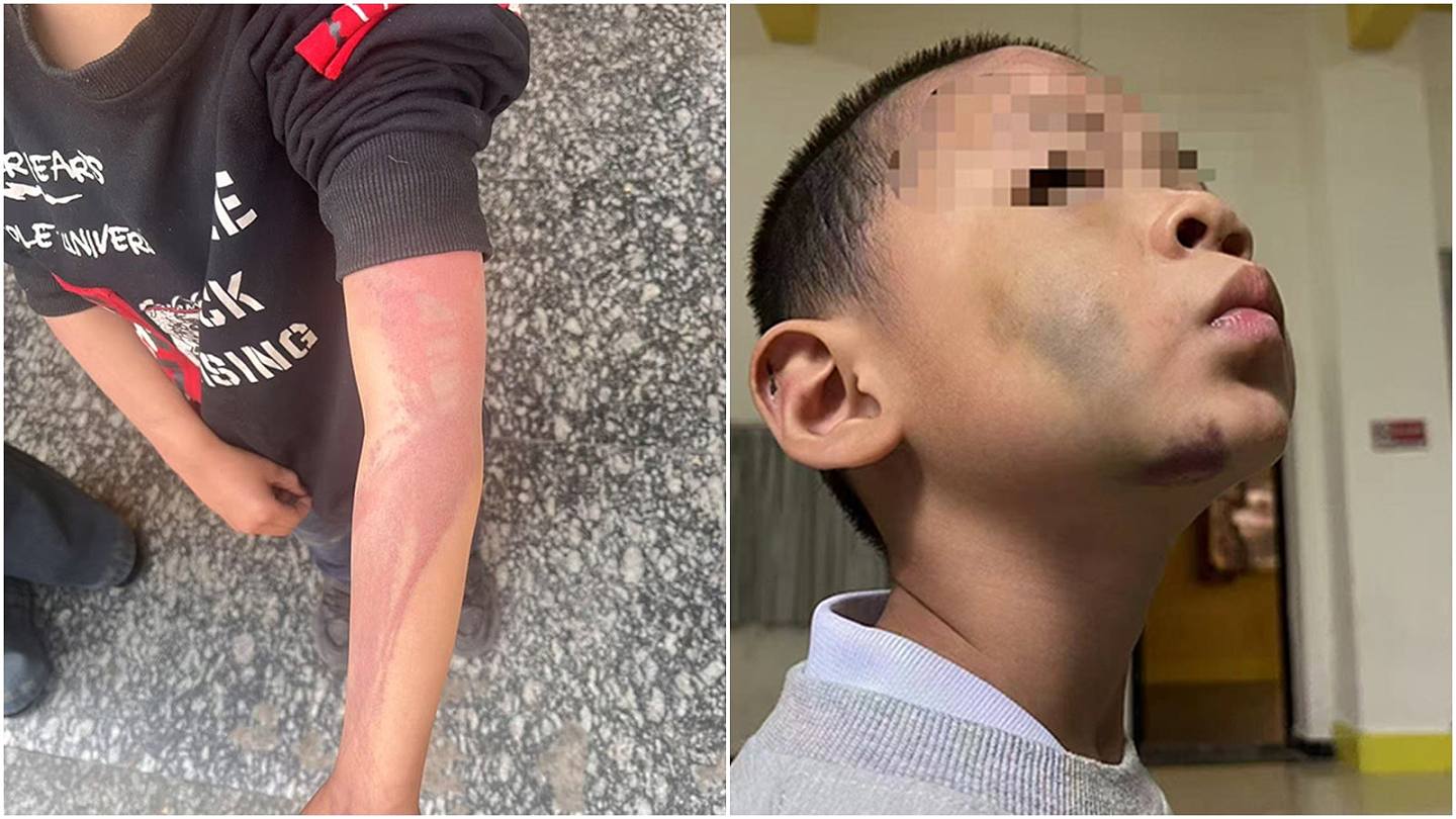 湖南男童疑被生父继母长期虐待全身损伤！生母：只有脚底板是好的（组图） - 1
