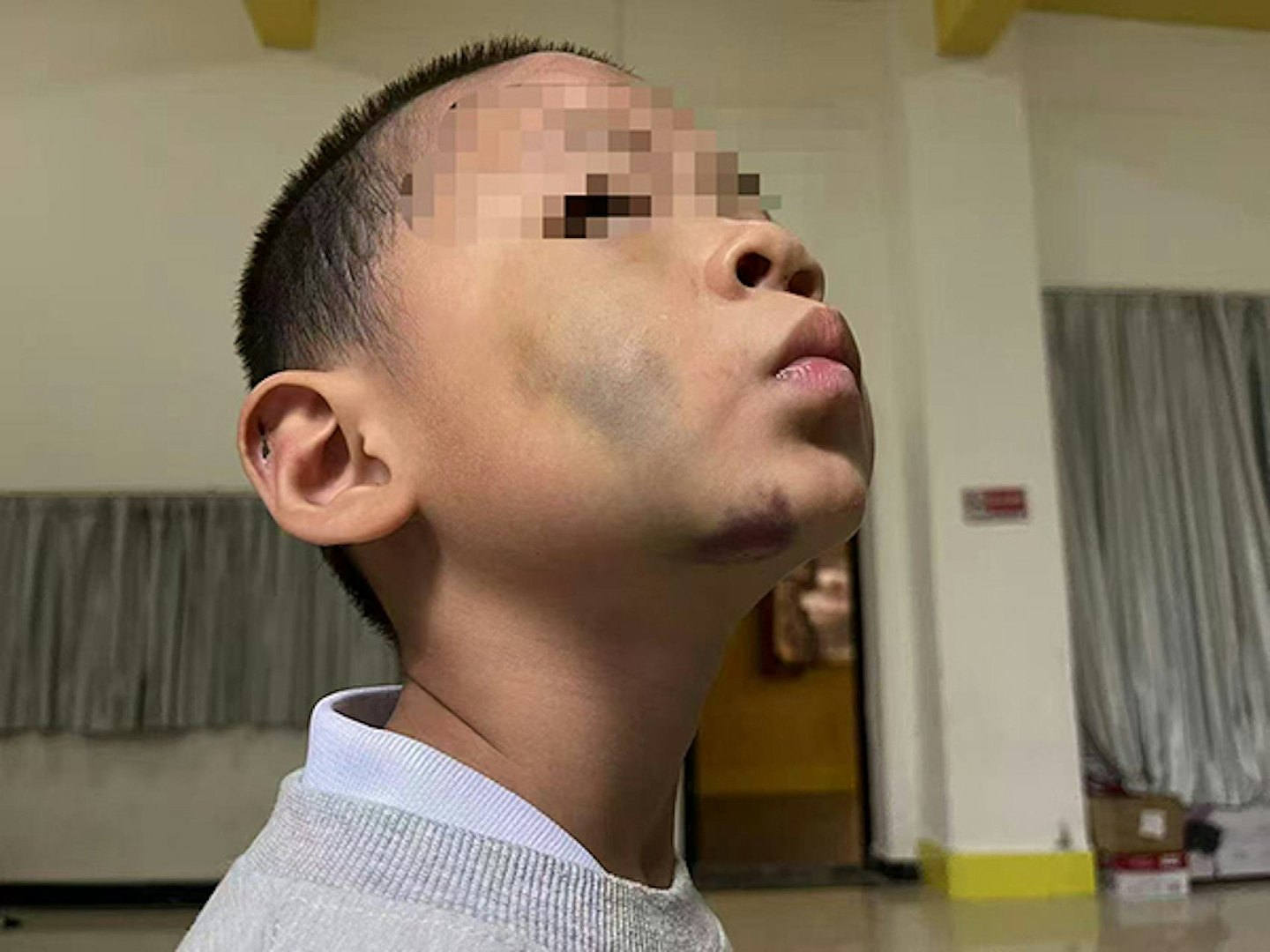 湖南男童疑被生父继母长期虐待全身损伤！生母：只有脚底板是好的（组图） - 3