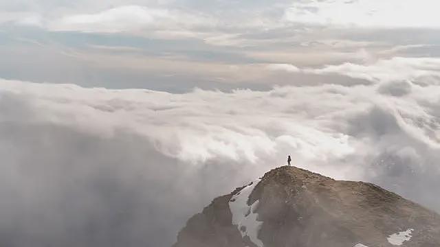 对人类也会过敏的人（组图） - 4