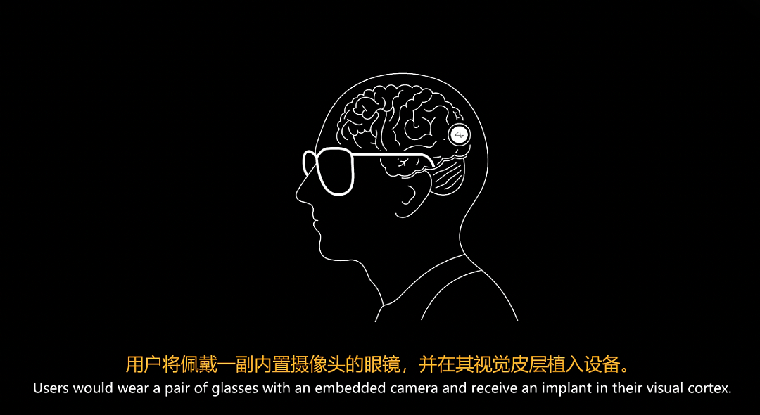马斯克切脑全场震撼！插脑只要1.5秒，26年治愈失明，28年全人类变AI（组图） - 21