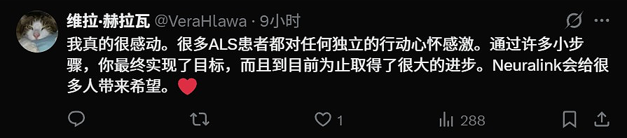 马斯克切脑全场震撼！插脑只要1.5秒，26年治愈失明，28年全人类变AI（组图） - 14