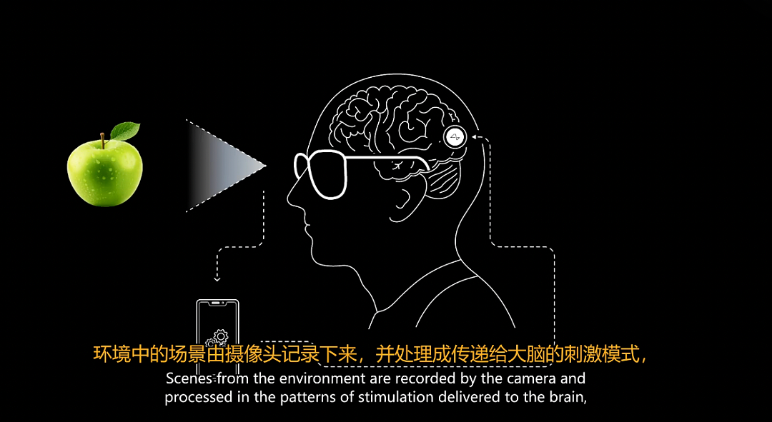 马斯克切脑全场震撼！插脑只要1.5秒，26年治愈失明，28年全人类变AI（组图） - 22