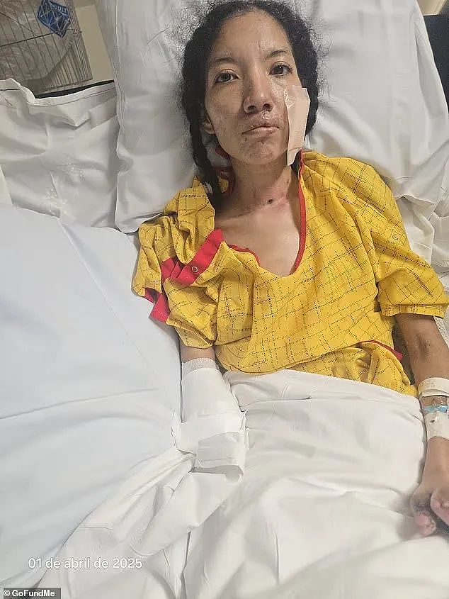 恐怖!普通感冒竟导致四肢截肢,39岁妈妈一夜间手脚全坏死,症状恐怖(组图) - 4