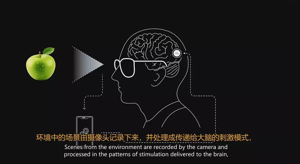 马斯克切脑全场震撼！插脑1.5秒，放言26年治愈失明（组图） - 18
