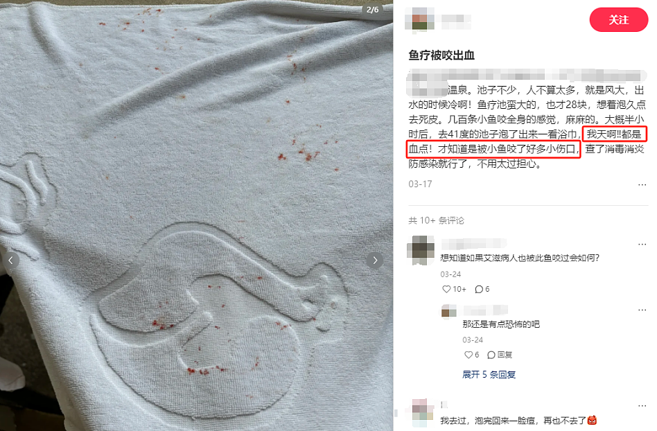 泡脚“鱼疗”后，澳洲女子被截掉了5个脚趾！这5类人千万不要随意尝试（组图） - 5