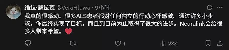 马斯克切脑全场震撼！插脑1.5秒，放言26年治愈失明（组图） - 11