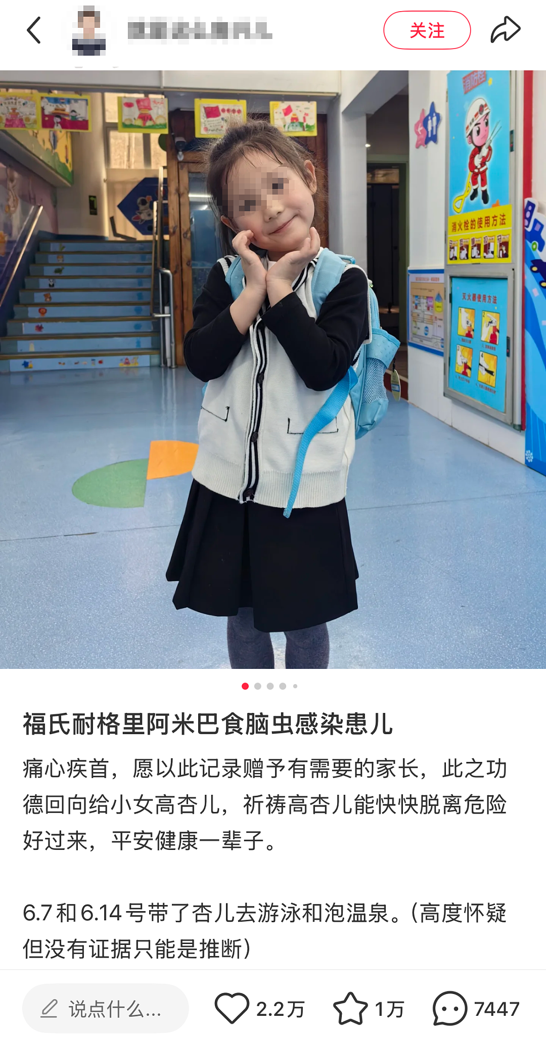 “医生好像已经宣判死刑......”5岁女童游泳、泡温泉后昏迷不醒,上了呼吸机!这病有多凶险?(组图) - 1