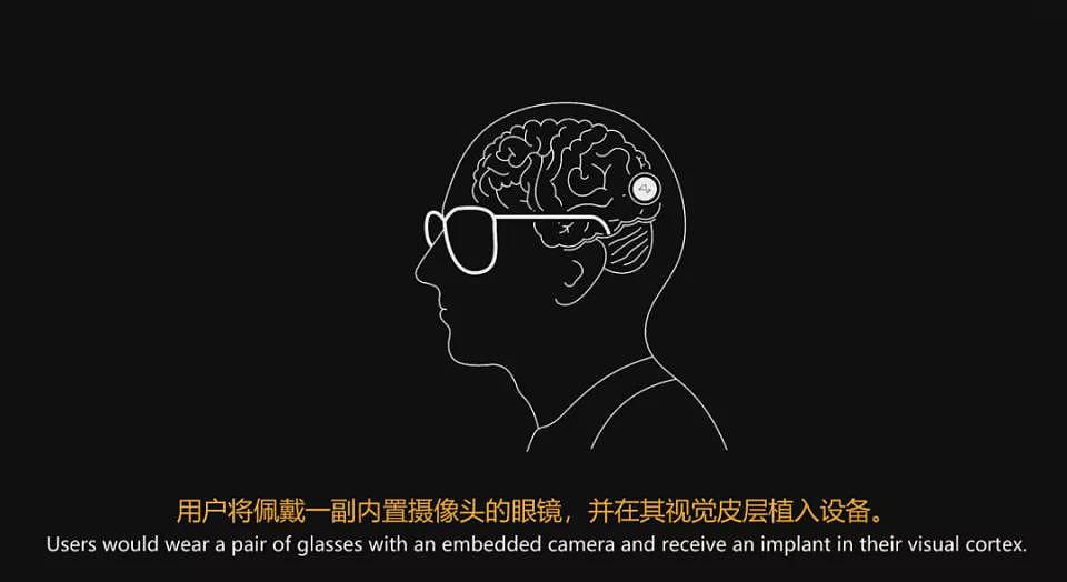 马斯克切脑全场震撼！插脑1.5秒，放言26年治愈失明（组图） - 17