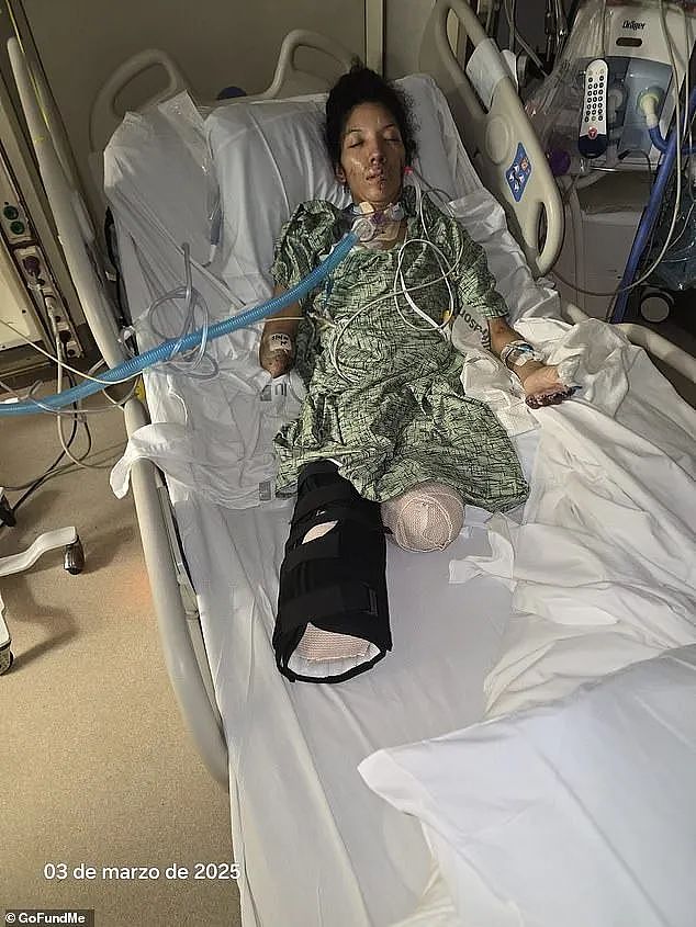 恐怖!普通感冒竟导致四肢截肢,39岁妈妈一夜间手脚全坏死,症状恐怖(组图) - 1