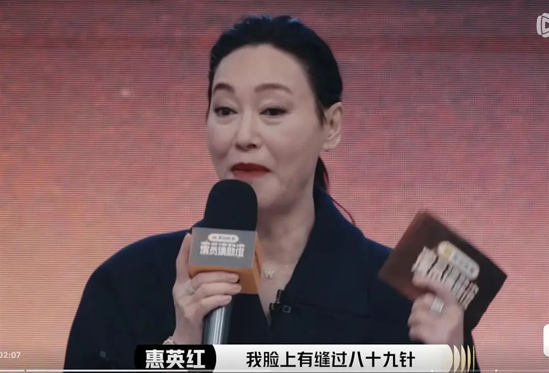 65岁惠英红自曝：曾抑郁5年！自杀被家人救回，“开工，我就有生命！”（组图） - 2