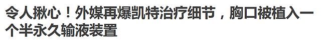 凯特王妃病情出现反复,英国媒体曝出治疗细节(组图) - 1