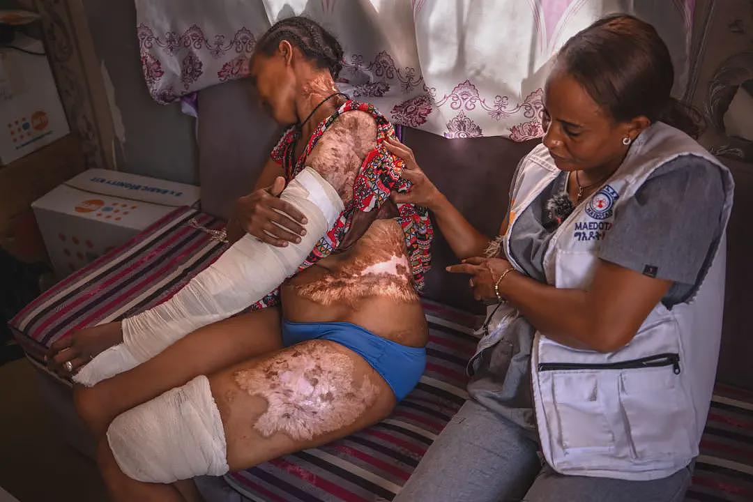 插入子宫的锈钉：提格雷女性遭受骇人听闻的性暴力（组图） - 9