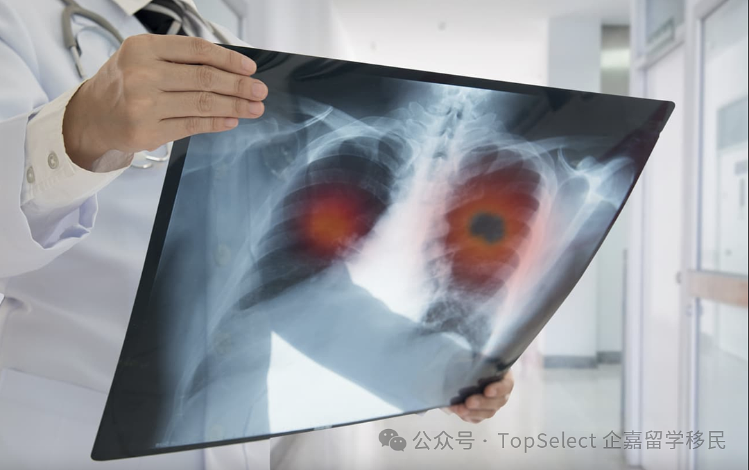 重大通知:今天起,澳洲正式启动国家级“救命”福利!免费参与,只需满足这4个条件!(组图) - 6