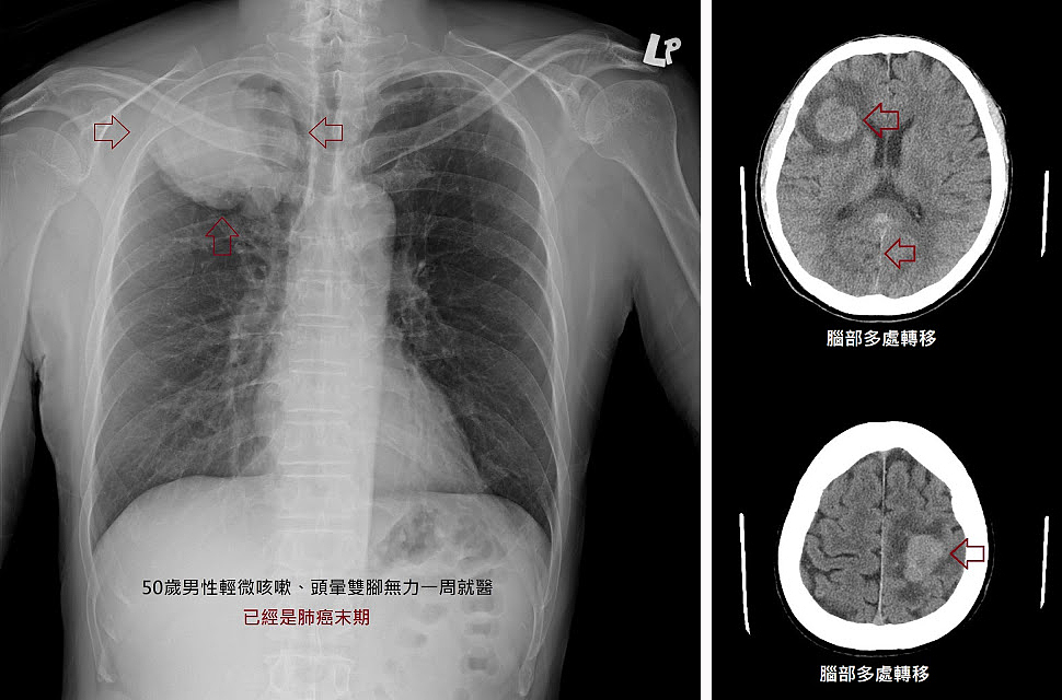 重大通知:今天起,澳洲正式启动国家级“救命”福利!免费参与,只需满足这4个条件!(组图) - 3