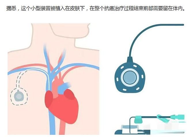 凯特王妃病情出现反复,英国媒体曝出治疗细节(组图) - 2