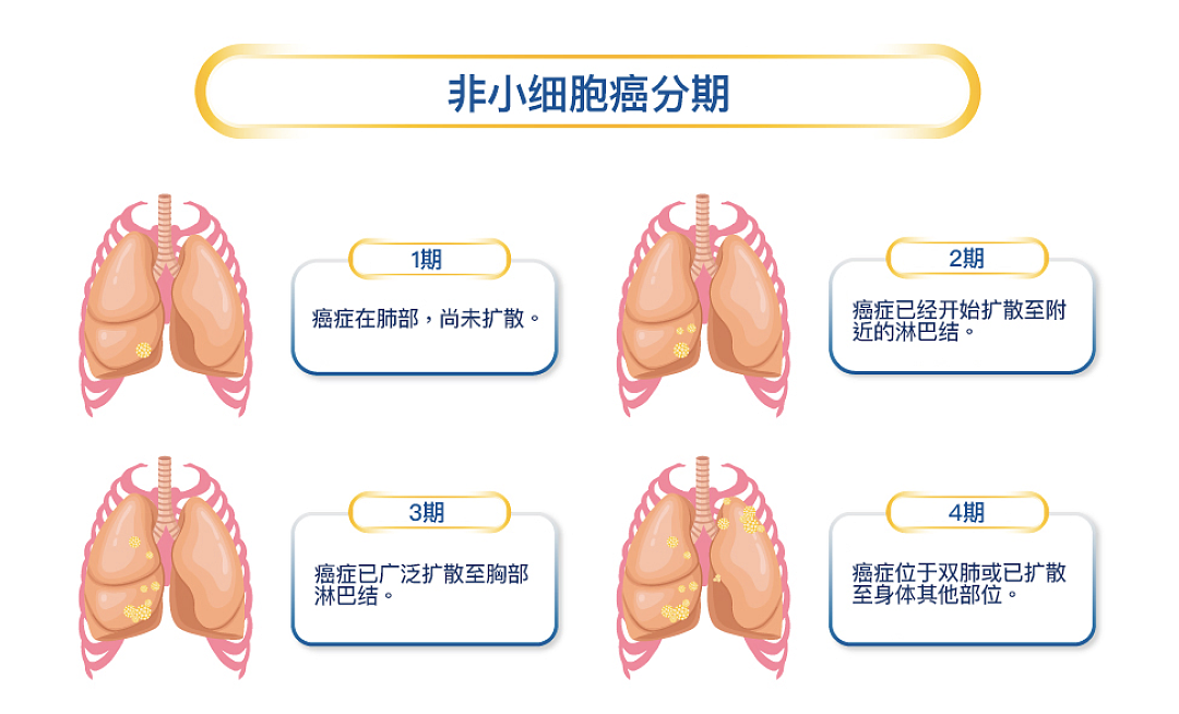 斥资$2.6亿！澳洲史上首次！以后所有人都可以免费肺癌筛查啦（组图） - 2