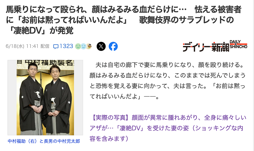 日本歌舞伎贵公子家暴妻子致骨折!事后携亲爹跪求原谅称:再打你就打款1000万(组图) - 2