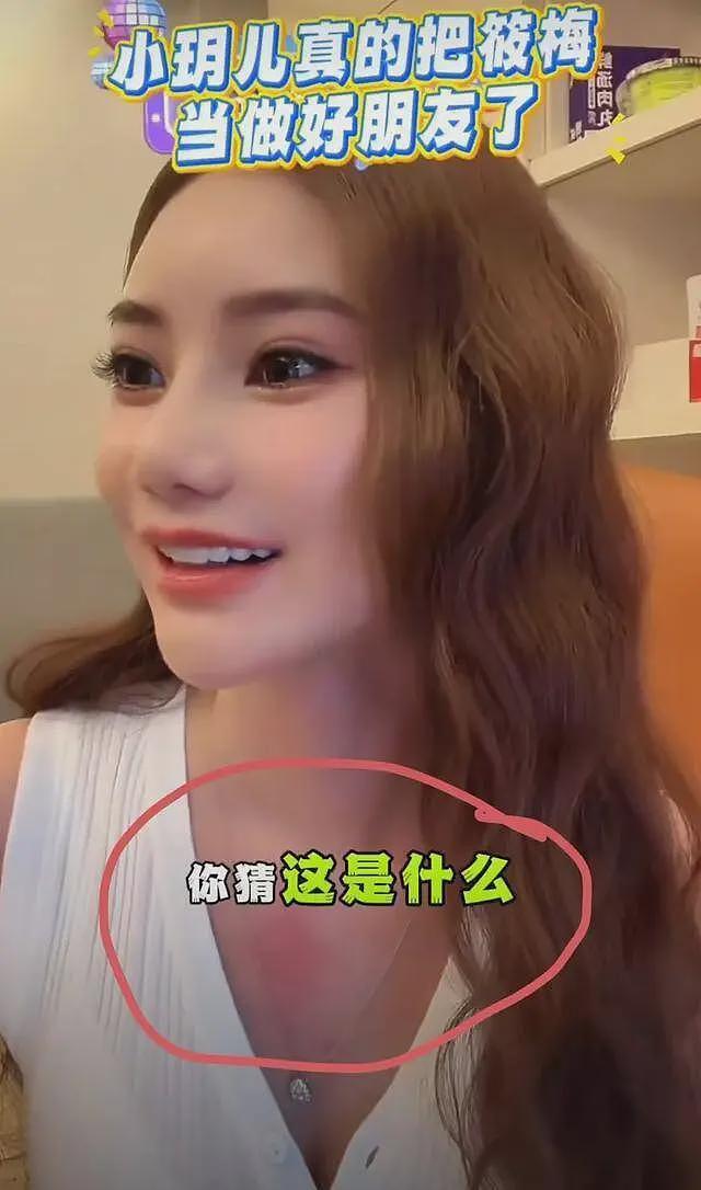 马筱梅深夜直播不挂链接，手臂淤青、胸口红肿，汪小菲被质疑家暴（组图） - 4