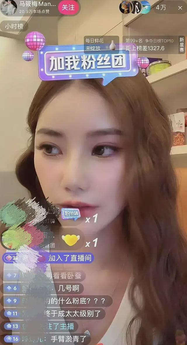 马筱梅深夜直播不挂链接，手臂淤青、胸口红肿，汪小菲被质疑家暴（组图） - 5