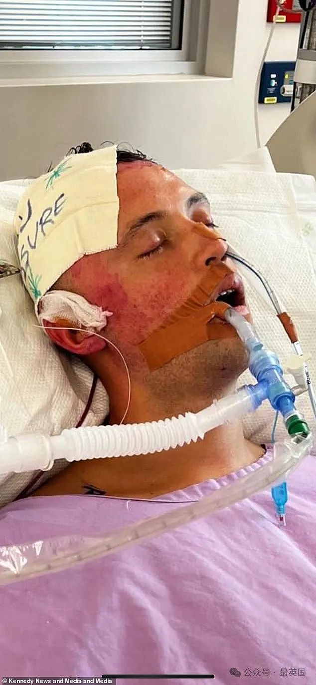 30岁英国健身达人小伙洗澡时突然倒地疯狂呕吐！诊断结果震惊所有人！或终身致残…（组图） - 4