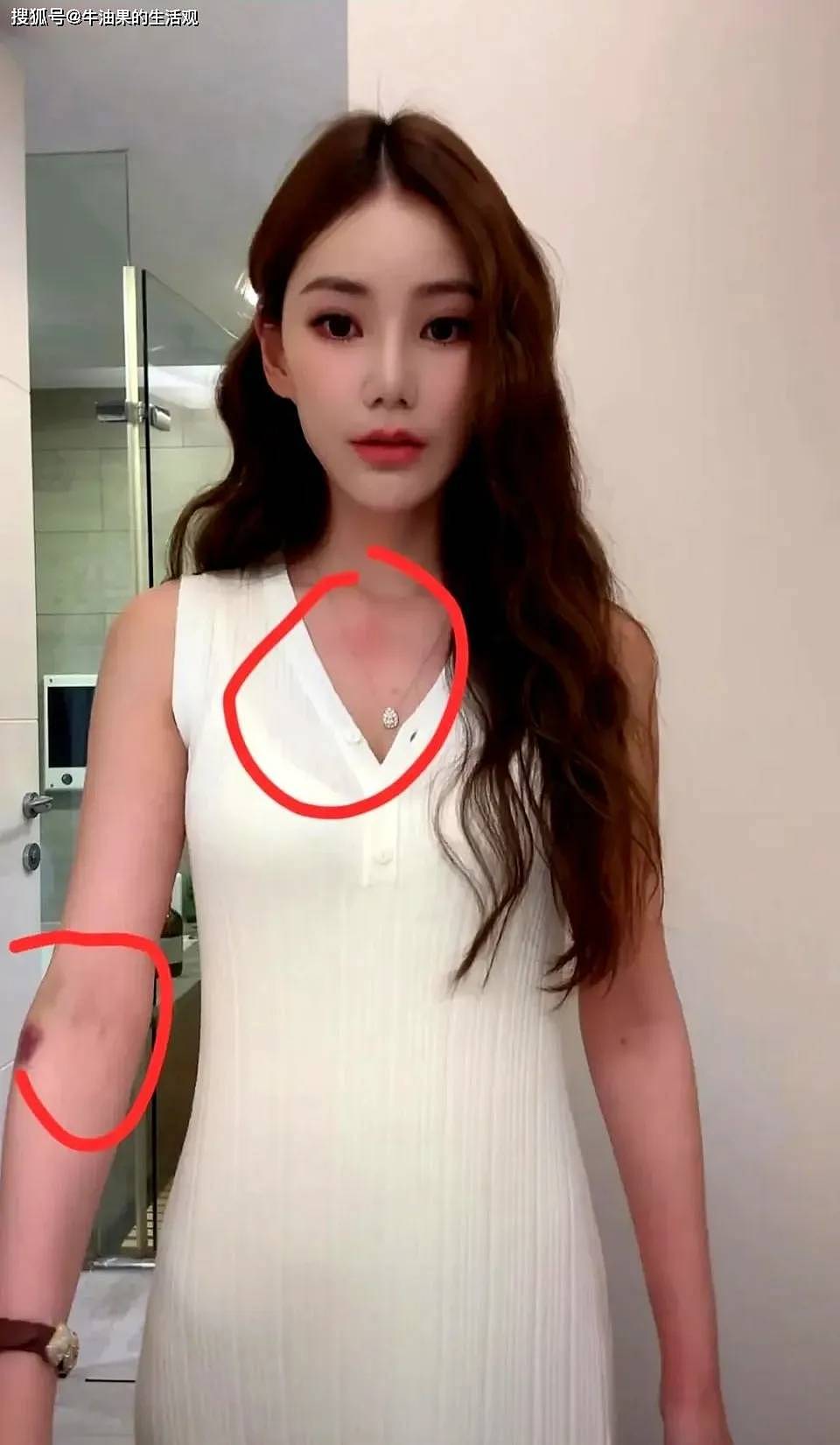 汪小菲夫妻回台北,马筱梅身上好多淤青(组图) - 4