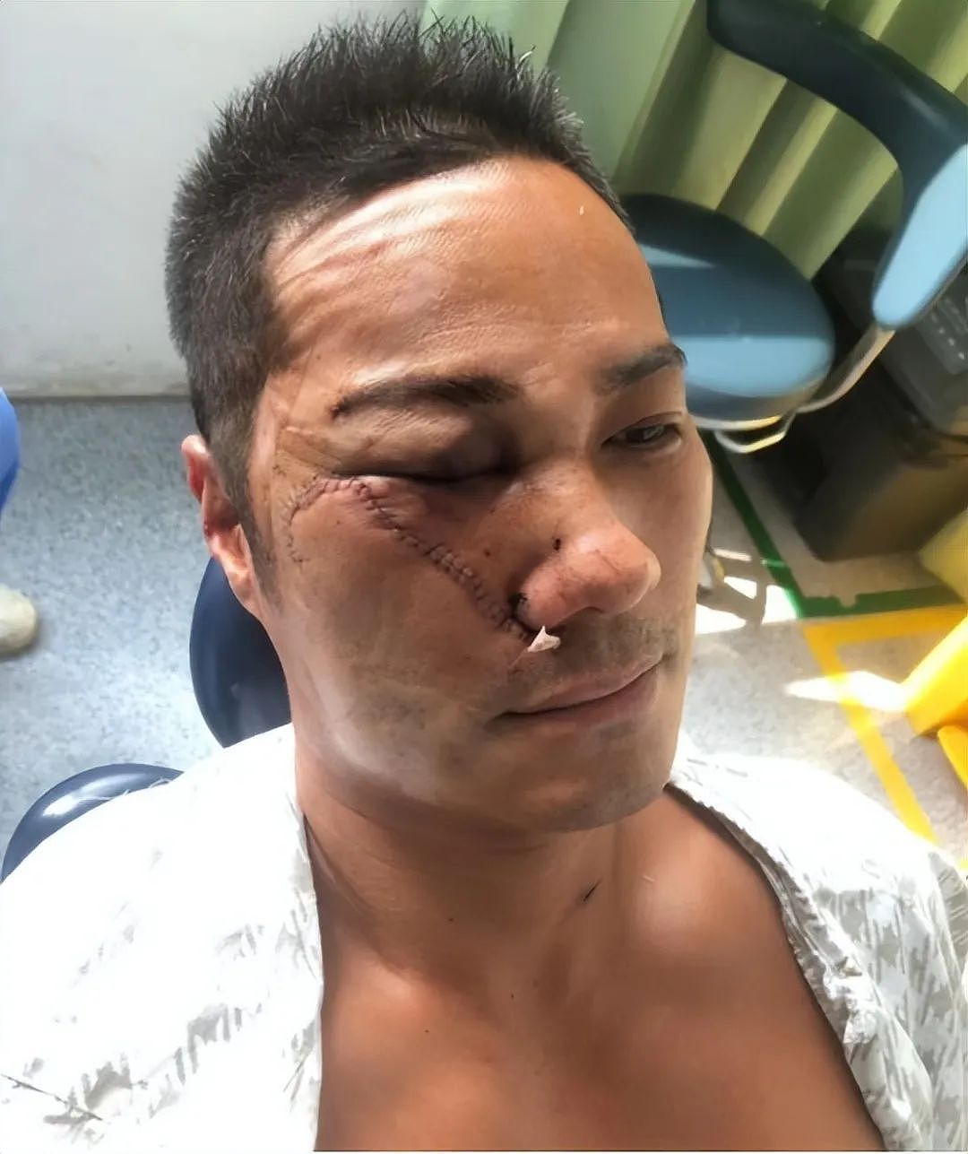 香港“翻版古天乐”曾遇突袭,被砍三刀险些丧命,自曝细节细思极恐(组图) - 8