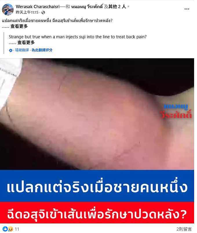 医揭奇葩案例！33岁男注射精液治背痛，他连续18个月靠自创疗法感染脓疡（组图） - 2