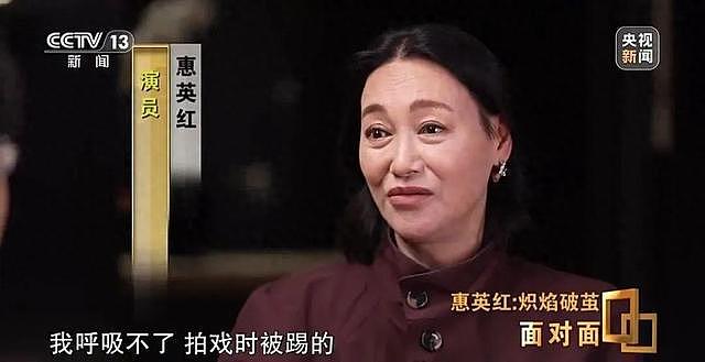 65岁惠英红回应脸上缝过89针!自杀被家人救回,“开工,我就有生命”(组图) - 1