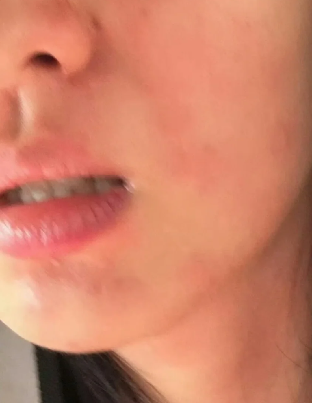 “痒到崩溃”！女演员晒照求助，网友大呼感同身受：太折磨人了，简直想把皮挠掉（组图） - 1