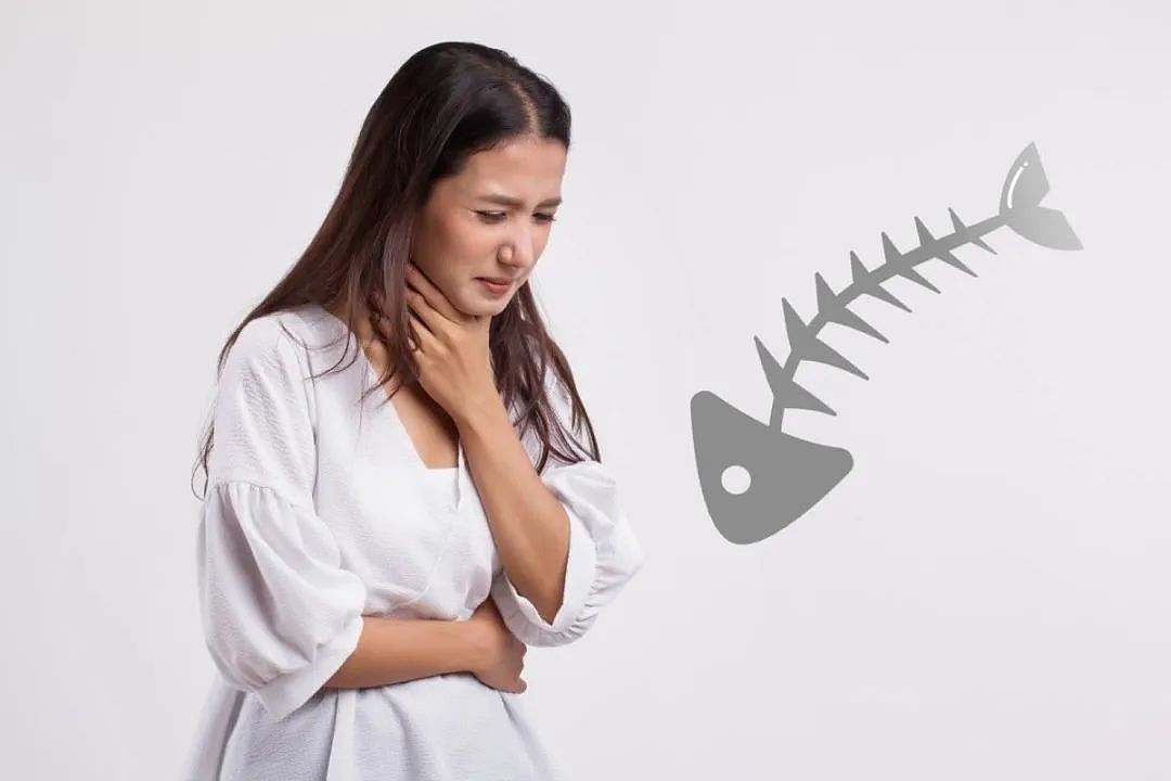 离谱！外国女子吃饭被鱼刺卡喉，2次就医被误诊“没事”，三周后竟从脖子一侧刺出（组图） - 8