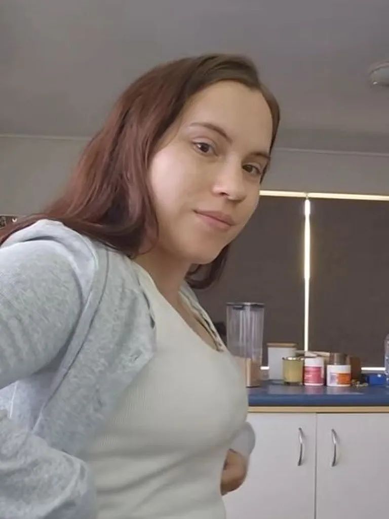 缩胸女孩痛哭，感动无数网友！澳洲越来越流行这种手术！（组图） - 3