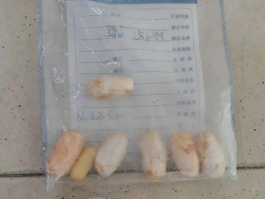 非裔男子用身体藏毒被广州海关查获，排出7颗毒丸（组图） - 3