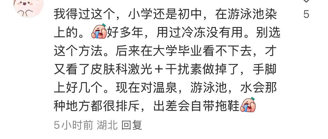 热搜！酒店光脚洗澡竟会感染HPV？真相来了！医生提醒：避免在公共场所这样做（组图） - 4